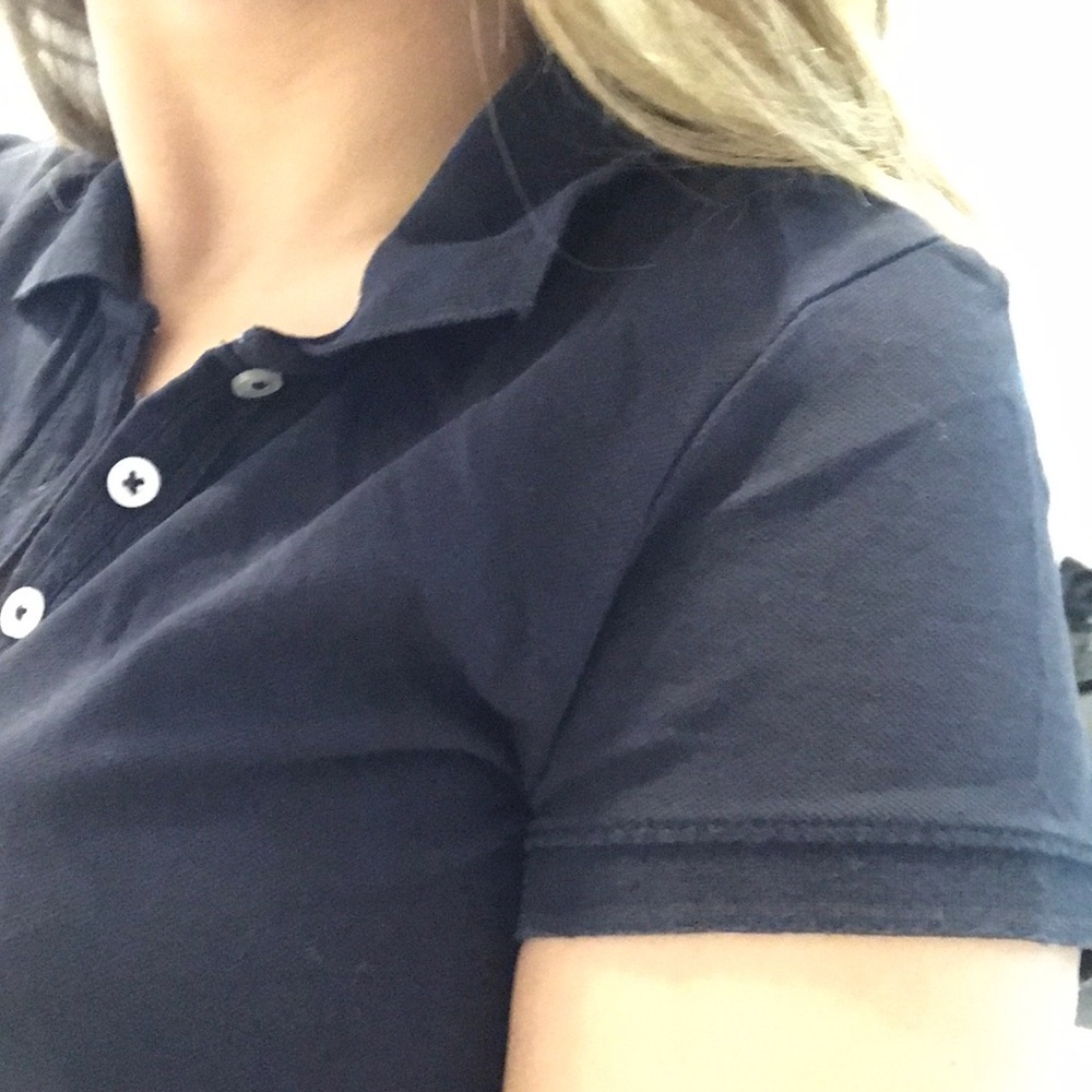 Button Top - Picture 5 of 5